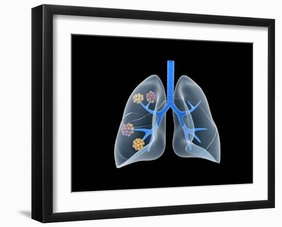 Conceptual Image of Human Lungs-null-Framed Art Print