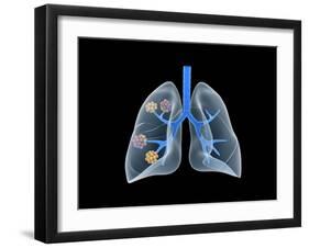 Conceptual Image of Human Lungs-null-Framed Art Print