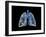 Conceptual Image of Human Lungs-null-Framed Art Print