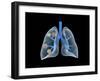 Conceptual Image of Human Lungs-null-Framed Art Print