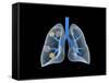 Conceptual Image of Human Lungs-null-Framed Stretched Canvas