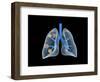 Conceptual Image of Human Lungs-null-Framed Art Print