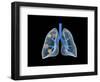 Conceptual Image of Human Lungs-null-Framed Art Print