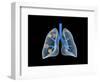 Conceptual Image of Human Lungs-null-Framed Art Print