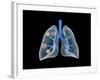 Conceptual Image of Human Lungs-null-Framed Art Print