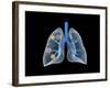 Conceptual Image of Human Lungs-null-Framed Art Print