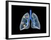 Conceptual Image of Human Lungs-null-Framed Art Print