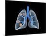 Conceptual Image of Human Lungs-null-Mounted Art Print