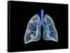 Conceptual Image of Human Lungs-null-Framed Stretched Canvas