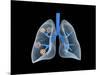 Conceptual Image of Human Lungs-null-Mounted Art Print