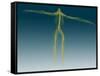 Conceptual Image of Human Nervous System-null-Framed Stretched Canvas