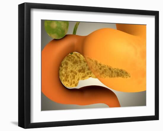 Conceptual Image of Human Pancreas and Stomach-null-Framed Art Print