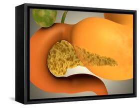 Conceptual Image of Human Pancreas and Stomach-null-Framed Stretched Canvas