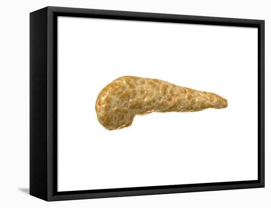 Conceptual Image of Human Pancreas-null-Framed Stretched Canvas