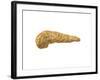 Conceptual Image of Human Pancreas-null-Framed Art Print