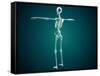 Conceptual Image of Human Skeletal System-null-Framed Stretched Canvas