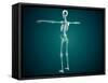 Conceptual Image of Human Skeletal System-null-Framed Stretched Canvas