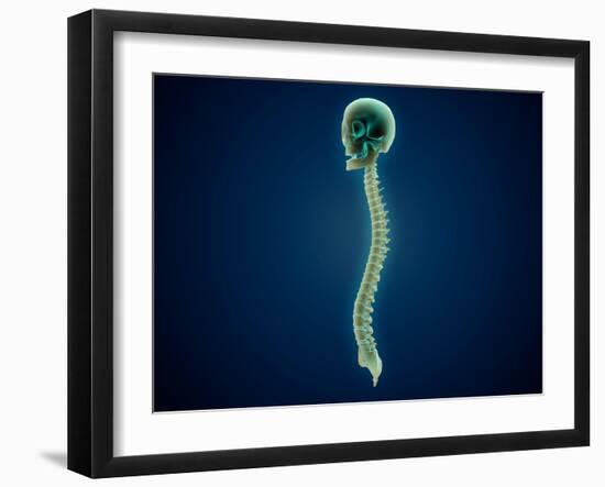 Conceptual Image of Human Skull and Spinal Cord-null-Framed Art Print