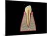 Conceptual Image of Human Tooth-null-Mounted Art Print