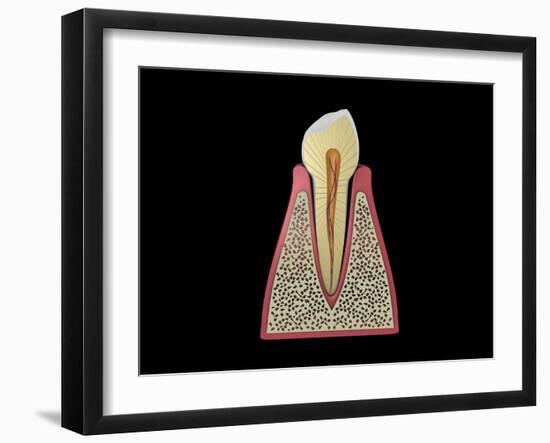 Conceptual Image of Human Tooth-null-Framed Art Print