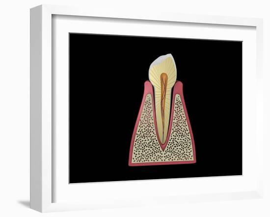 Conceptual Image of Human Tooth-null-Framed Art Print