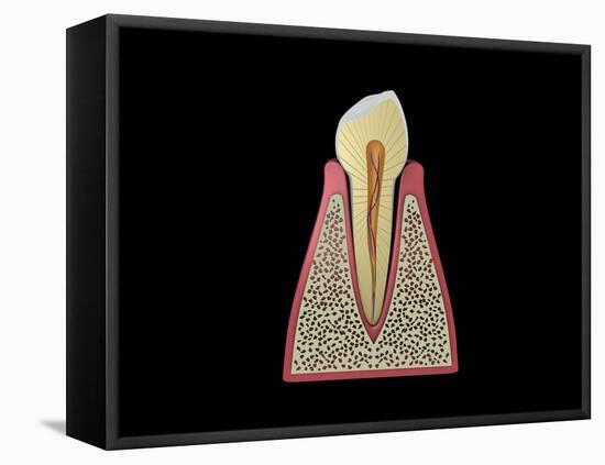 Conceptual Image of Human Tooth-null-Framed Stretched Canvas