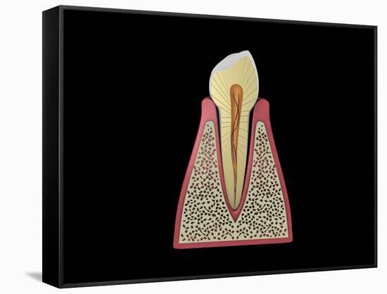 Conceptual Image of Human Tooth-null-Framed Stretched Canvas