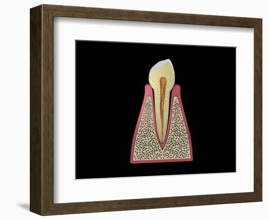 Conceptual Image of Human Tooth-null-Framed Art Print