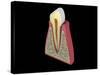 Conceptual Image of Human Tooth-null-Stretched Canvas