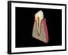 Conceptual Image of Human Tooth-null-Framed Art Print