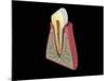 Conceptual Image of Human Tooth-null-Mounted Art Print