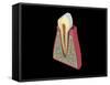 Conceptual Image of Human Tooth-null-Framed Stretched Canvas