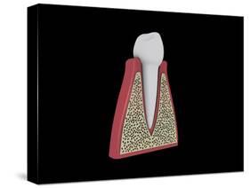 Conceptual Image of Human Tooth-null-Stretched Canvas