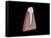 Conceptual Image of Human Tooth-null-Framed Stretched Canvas