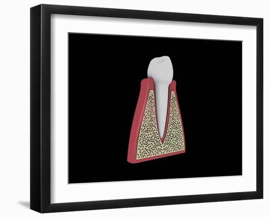 Conceptual Image of Human Tooth-null-Framed Art Print