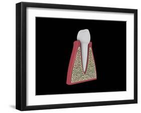 Conceptual Image of Human Tooth-null-Framed Art Print