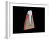 Conceptual Image of Human Tooth-null-Framed Art Print