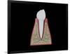 Conceptual Image of Human Tooth-null-Framed Art Print