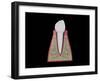 Conceptual Image of Human Tooth-null-Framed Art Print