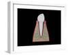 Conceptual Image of Human Tooth-null-Framed Art Print