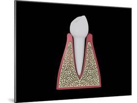 Conceptual Image of Human Tooth-null-Mounted Art Print