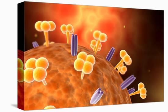 Conceptual Image of Influenza Causing Flu-null-Stretched Canvas