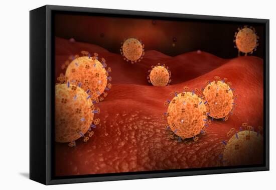 Conceptual Image of Influenza Causing Flu-null-Framed Stretched Canvas