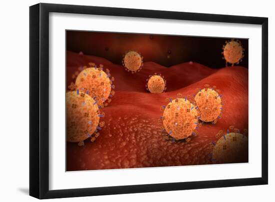 Conceptual Image of Influenza Causing Flu-null-Framed Art Print