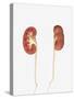 Conceptual Image of Kidneys Showing Renal Pelvis and Ureter-Stocktrek Images-Stretched Canvas