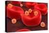 Conceptual Image of Malaria Parasites Within Red Blood Cells-null-Stretched Canvas