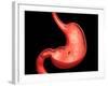 Conceptual Image of Peptic Ulcer in Human Stomach-null-Framed Art Print