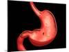 Conceptual Image of Peptic Ulcer in Human Stomach-null-Mounted Art Print