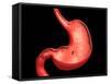 Conceptual Image of Peptic Ulcer in Human Stomach-null-Framed Stretched Canvas