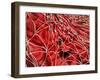 Conceptual Image of Red Blood Cells with Fibrin-null-Framed Art Print